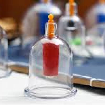 İleri Seviye Hacamat & Sülük Eğitimi